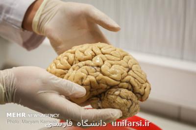 پژوهشگران مسیرهای شناخت مغز را سرعت دادند